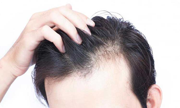 مؤثرترین شیوه‌های ضخیم کردن مو